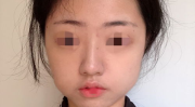 重庆私密整形的公立医院,重庆公立医院私密整形服务全面解析
